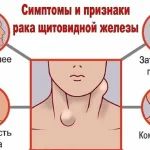 Рак шиї симптоми: ранні ознаки та небезпечні сигнали