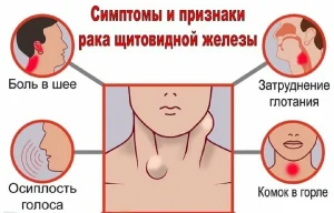 Рак шиї симптоми: ранні ознаки та небезпечні сигнали